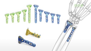 Implantes Ortopédicos Duraderos, Equipo Quirúrgico para Reparación de Huesos por Trauma, Herramientas de Implantes Médicos de Acero Inoxidable - Product Image 4