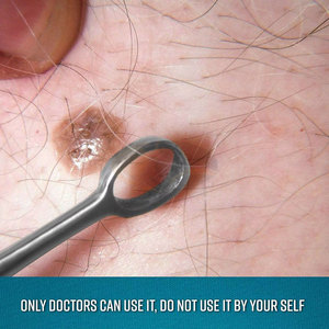 ชุดเครื่องมือขูดหูแบบแมนนวล JACKBILLY รุ่นล่าสุด 4 ชิ้น ผลิตจากสแตนเลสคุณภาพสูง เครื่องมือผ่าตัดหู คอ จมูก สำหรับทำความสะอาดหู - Product Image 4