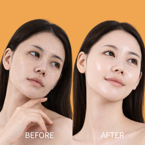 เซรั่มวิตามินซีเพื่อผิวกระจ่างใส ลดเลือนจุดด่างดำ ปรับสีผิวให้สม่ำเสมอ ด้วยกรดเฟอรูลิก กรดไฮยาลูรอนิก และ MSM รับผลิตแบบ OEM ODM - Product Image 6