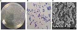 Bifidobacterium Infantis en Polvo Blanco para la Salud Intestinal Infantil, Afecciones Gastrointestinales Pediátricas, Alergias e Inflamaciones, 100 Mil Millones - Product Image 2