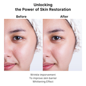 Emulsión de Esencia de Péptidos APOTHE 150 mL con Botulina y Niacinamida Hecho en Corea Antienvejecimiento Antiarrugas Blanqueador Cuidado Facial - Product Image 2