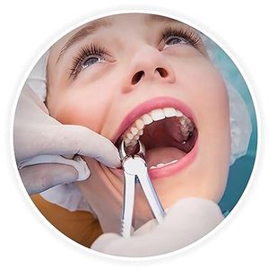 Pinzas de Extracción, Instrumento Quirúrgico para Extraer Dientes, para Molares Superiores e Inferiores, Dientes del Sabiduría, Uso Profesional por Dentistas, Aprobado por ISO - Product Image 6