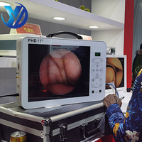 Système de caméra endoscopique médicale portable Ocean 17 pouces Full HD pour laparoscopie, hystéroscopie, chirurgie ORL