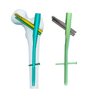 Clavo Intramedular Femoral Intertan con Tornillo de Compresión Integrado, Anti-Rotación, Aleación de Titanio, Sistema con Certificación CE - Product Image 1
