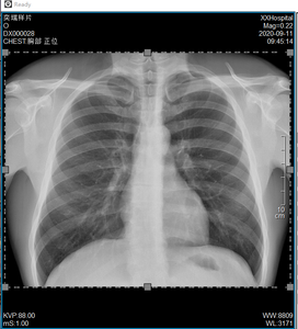 Detector de panel plano de rayos X inalámbrico de alta calidad <span class=keywords><strong>DR</strong></span> para sistema de imágenes gráficas de radiación para control de salud humana - Product Image 5