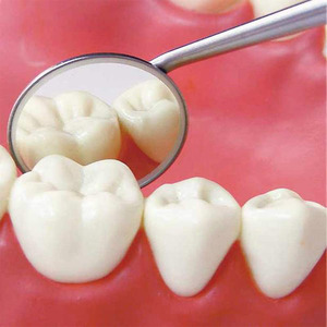 Miroirs de chirurgie buccale de haute qualité, en acier chirurgical, amovibles, certifiés CE, miroirs dentaires de classe I - Product Image 6