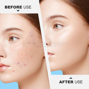 Extractor de Comedones de Precisión Premium de Acero Inoxidable para Tratamiento del Acné Facial, Superficie Lisa con Acabado Fino y Fácil Control - Product Image 6