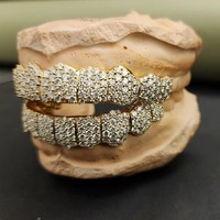 Grillz de luxe personnalisés en or rose, sertis de diamants Moissanite VVS1 taille brillant ronde, pour hommes et femmes, prix de gros