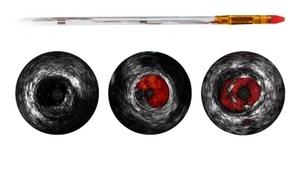 VOLCANO EAGLE EYE PLATINUM ST Ensemble d'instruments manuels à usage hospitalier Certifié CE Dispositif médical de classe II Certifié ISO13485 1 an - Product Image 5