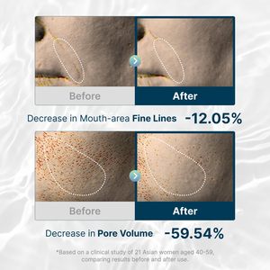 Mascarilla Facial Nocturna Vegana ROOTIO con Colágeno, Blanqueadora, Minimiza Poros, Reafirmante y Antienvejecimiento, Cuidado Facial Coreano - Product Image 3