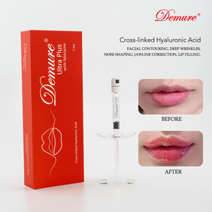 Relleno Dérmico Inyectable <span class=keywords><strong>de</strong></span> Ácido Hialurónico OEM, Gel <span class=keywords><strong>de</strong></span> HA Reticulado <span class=keywords><strong>para</strong></span> <span class=keywords><strong>Aumento</strong></span> <span class=keywords><strong>de</strong></span> <span class=keywords><strong>Labios</strong></span>, Relleno <span class=keywords><strong>de</strong></span> <span class=keywords><strong>Labios</strong></span>, Contorno Facial <span class=keywords><strong>de</strong></span> Nariz y Mentón - Product Image 5