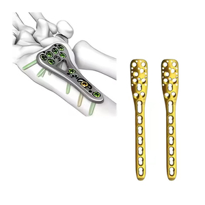 Juego de Instrumentos de Acero Inoxidable de Alta Calidad para Placa de Bloqueo Pélvico, Ortopedia y Traumatología, para Reconstrucción Pélvica Quirúrgica - Product Image 1
