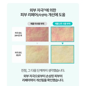 เซรั่มบำรุงผิวหน้าเกาหลี K-Beauty 80 มล. ไฮเปอร์ช็อต ซิก้า พีดีอาร์เอ็น แอมพูล เซนเทลล่า เอเชียติก้า ไนอะซินาไมด์ บำรุงผิว ลดการระคายเคือง - Product Image 5