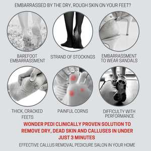 SHEARS BEAUTY SB-FCR-710 Removedor de Callos de Pies Recargable a Batería, Resistente al Agua, Duradero para Uso en Seco y Húmedo, Uso Doméstico - Product Image 2