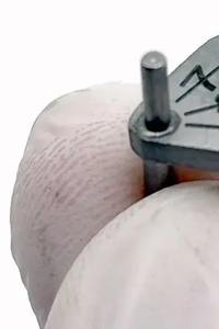 เครื่องมือกำหนดตำแหน่งรากฟันเทียม ไม้บรรทัดกำหนดตำแหน่ง เครื่องมือวัดระยะห่างรากฟันเทียมแบบขนาน ทำจากสแตนเลส สำหรับการแพทย์ - Product Image 2