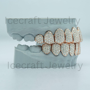 Ensemble de Grillz de Luxe Premium en Moissanite VVS, Bijoux Dentaires Faits Main en Argent Sterling 925, Fabricant Grossiste - Product Image 2