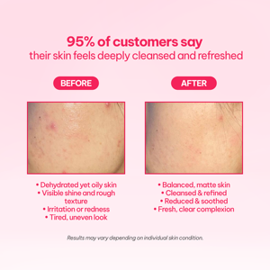 Crème hydratante sans huile Millford AC à la niacinamide, 80 ml, tube, hydratant pour le visage coréen pour tous types de peau, fabriqué en Corée - Product Image 6