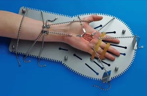 Soporte de Mano Universal Tupper, Juego de Mesa de Acero Inoxidable Premium, Herramienta Reutilizable para Posicionamiento en Cirugía Ortopédica - Product Image 2