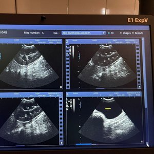 Ecógrafo Veterinario Portátil E1ExpV SonoScape con Doppler Color para Diagnóstico Reproductivo y de Gestación <span class=keywords><strong>Abdominal</strong></span> - Product Image 6