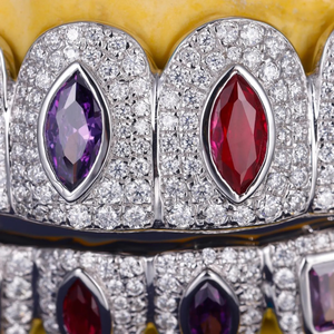 Joyería Hip Hop de Lujo: Grillz Dentales Personalizados de Plata 925 Bañada en Oro con Moissanita Iced Out, Certificado IGI, Engaste de Canal - Product Image 5