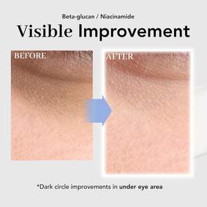 นอวาเตอร์ ทีวัน พรีสทีจ คอลลาเจน อาย ครีม 25 มล. |   ผลิตภัณฑ์บำรุงผิวหน้าสูตรต่อต้านริ้วรอยจากเกาหลี ลดรอยคล้ำ ริ้วรอยเล็กๆ กระชับผิว - Product Image 4