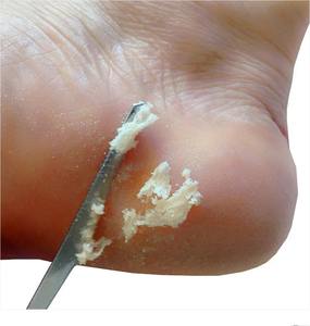 Râpe à pieds en acier inoxydable pour ongles et peaux mortes, couteau de pédicure, lime à talons, outils de manucure et pédicure - Product Image 2