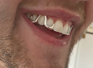 Grillz dentaire en argent sterling 925 massif, style hip-hop, bijou dentaire unisexe, pour usage quotidien, capuchon dentaire en métal - Product Image 4