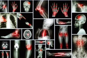 <span class=keywords><strong>X</strong></span>ách tay kỹ thuật số <span class=keywords><strong>Mini</strong></span> Xray máy với phẳng Detector - Product Image 3