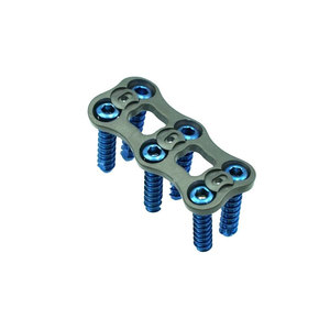 Juego de Implantes Quirúrgicos de Placa Ósea Ortopédica, Instrumento de Reducción Manual, Certificado CE, Acero Inoxidable Clase II, Tamaño Personalizado - Product Image 1