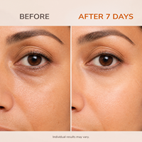 Crème Contour des Yeux Éclatante Vitamine C et Caféine – Atténue Cernes et Poches – Hydratation 24H – Acide Hyaluronique – Marque Blanche