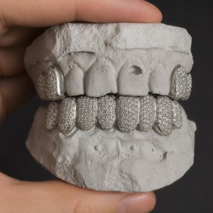 Grillz personnalisés faits à la main, bijoux dentaires Hip Hop, argent 925 plaqué rhodium, entièrement pavé, ensemble unisexe de 12 pièces - Product Image 1