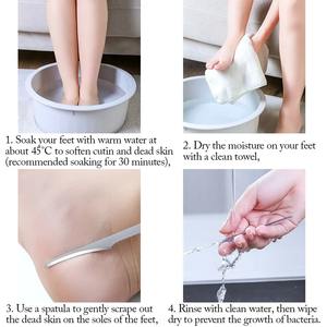 Râpe à pieds en acier inoxydable pour ongles et peaux mortes, couteau de pédicure, lime à talons, outils de manucure et pédicure - Product Image 5