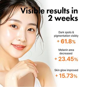 Ampolla Blanqueadora para Manchas Oscuras Apothe Exosome Mela-Glu 30ml, Suero Facial con Niacinamida de Uva, Cuidado de la Piel Coreano, Vida Útil de 3 Años - Product Image 4