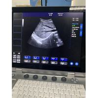 Escáner Ultrasónico para Embarazo a Precio de Fábrica, Máquina de Ultrasonido Fácil de Transportar, Portátil y Ligera para Hospital y Veterinaria