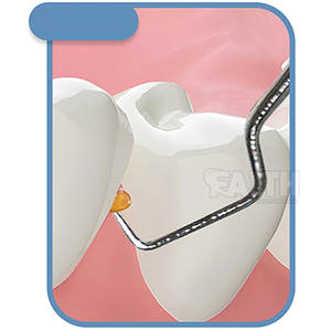 Curettes dentaires Gracey de qualité supérieure, dernier design, vente en gros d'instruments chirurgicaux dentaires, curette Gracey - Product Image 3