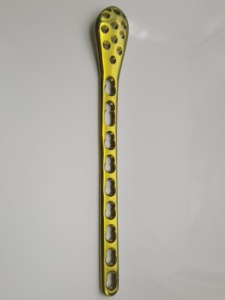 Factory Price Orthopedic Surgical Medical Implant Proximal Lateral Tibia Fracture Locking Plate Set - Product Image 5