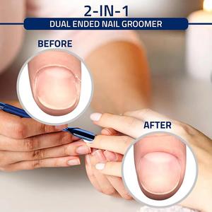 Pousse-cuticules double embout en acier inoxydable, réutilisable, manucure, double tête, manche bleu, soin professionnel des ongles - Product Image 2