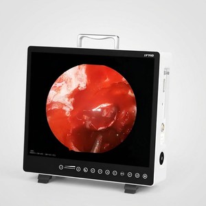Sistema de Cámara Endoscópica Médica <span class=keywords><strong>Integrada</strong></span> Todo en Uno Ocean de 19 Pulgadas FHD 1080P para Cirugía, Otorrinolaringología y Urología - Product Image 1