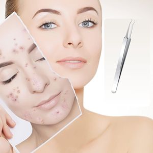 Stainless Steel <b>Blackhead</b> Tweezers Pimple <b>Extractor</b> Tool Curved Bend Design for Whitehead Removal Skin Care Instruments - Product Image 5