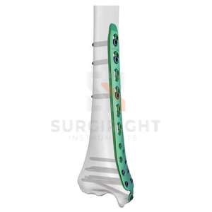 เครื่องมือเจาะข้อเข่าสำหรับการผ่าตัดเอซีแอล (ACL)  แบบใช้มือ  พร้อมใบรับรองมาตรฐาน CE สำหรับการผ่าตัดกระดูกและข้อ - Product Image 1