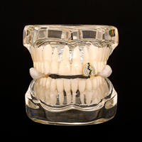 Grillz Dentales de la Mejor Calidad con Diamantes de Imitación en Forma de Corazón, Chapados en Oro, Estilo Hiphop, Joyería de Moda Unisex, Accesorio para Fiestas, de la India
