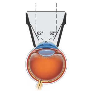 เครื่องมือผ่าตัดตาแบบใช้มือ รุ่น Science Surgical SS-54 โกนิโอเลนส์แบบสองกระจก โครงโลหะสีดำ ได้รับการรับรองมาตรฐาน ISO13485 - Product Image 3