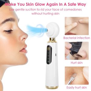 เครื่องดูดสิวเสี้ยนแบบพกพา เครื่องดูดสิวเสี้ยนบนใบหน้า อุปกรณ์เสริมความงามสำหรับขจัดสิ่งสกปรกและน้ำมันส่วนเกิน - Product Image 1