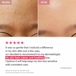 Tónico Coreano de Árbol de Té para Piel Propensa al Acné, Hidratante, Refinador con PHA, Calmante, Control de Grasa, Solución para una Piel Luminosa y Clara - Product Image 2