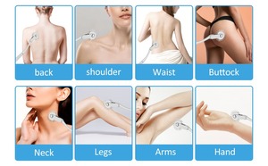 Roue sensorielle Wartenberg en acier inoxydable à 5 têtes, outil de diagnostic neurologique arc-en-ciel, sensibilité nerveuse ORL - Product Image 2