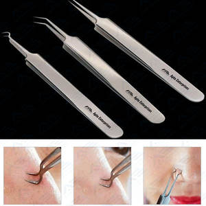 Eliminador de espinillas, cuidado de la piel, tratamiento de belleza para el acné, limpiador de poros, gancho de aguja, instrumentos de belleza para nariz y cara - Product Image 2