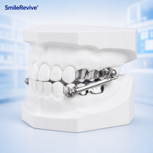 Dispositivo Ortodontico Funzionale SmileRevive Herbst Personalizzato, Correzione Classe III, Avanzamento Mandibolare, Adattamento Digitale Personalizzato - Product Image 4