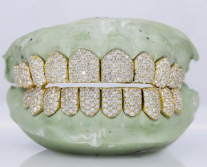 Grillz en argent sterling 925 sertis de moissanite, ajustement personnalisé, bijoux dentaires pour hommes et femmes, accessoire de mode - Product Image 4