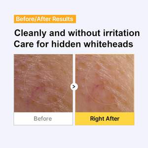 Toallitas Tonificantes de Algodón Apothe E Xosome Anti-Polución - Toallitas Exfoliantes y Tonificantes para el Cuidado de la Piel Coreana - Product Image 5