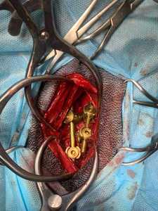 Rétracteur auto-rétractable Gelpi 70 mm x 190 mm en acier inoxydable réglable pour la chirurgie animale, instrument chirurgical vétérinaire - Product Image 4